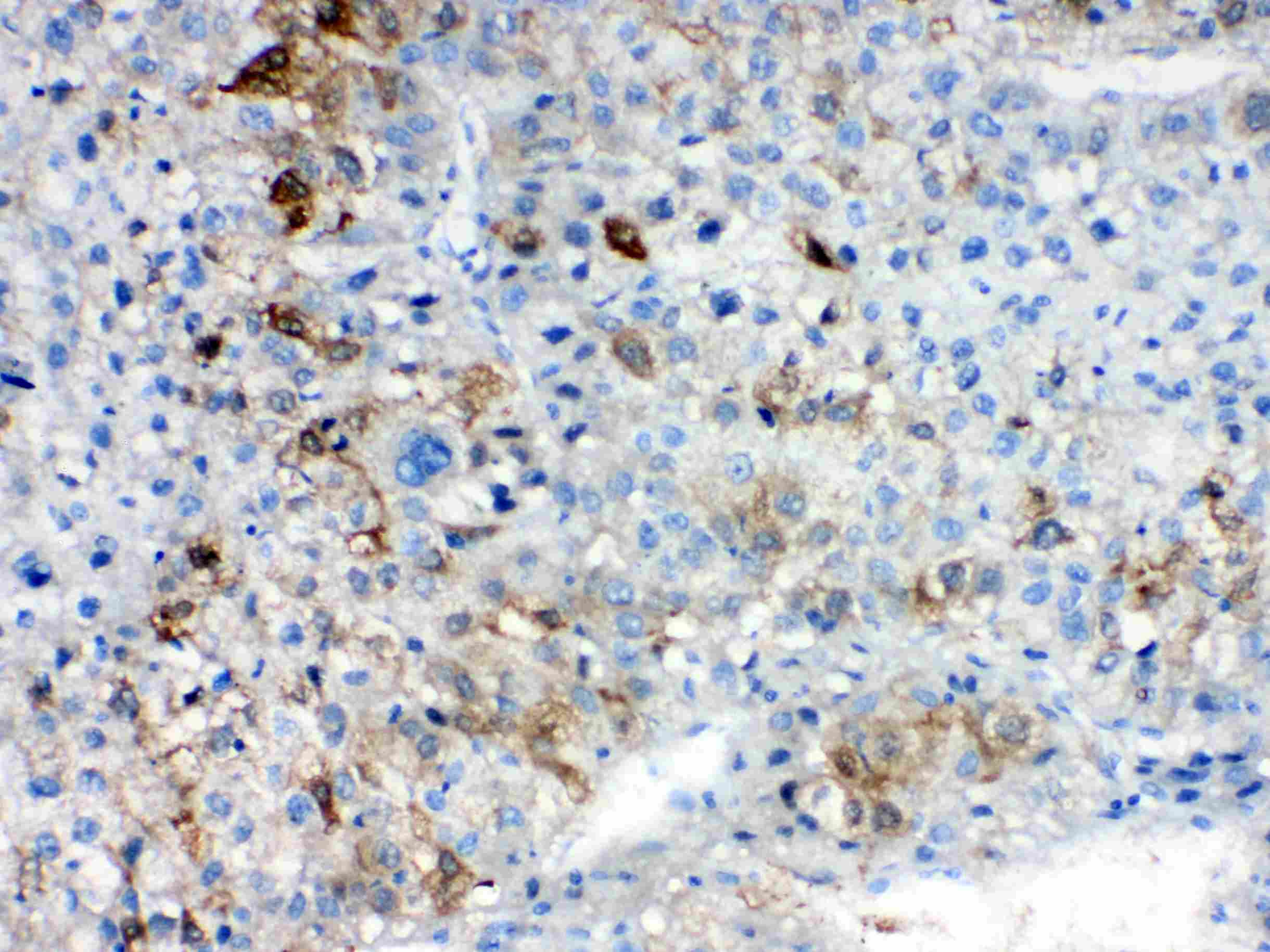 AKR1B10 Antibody