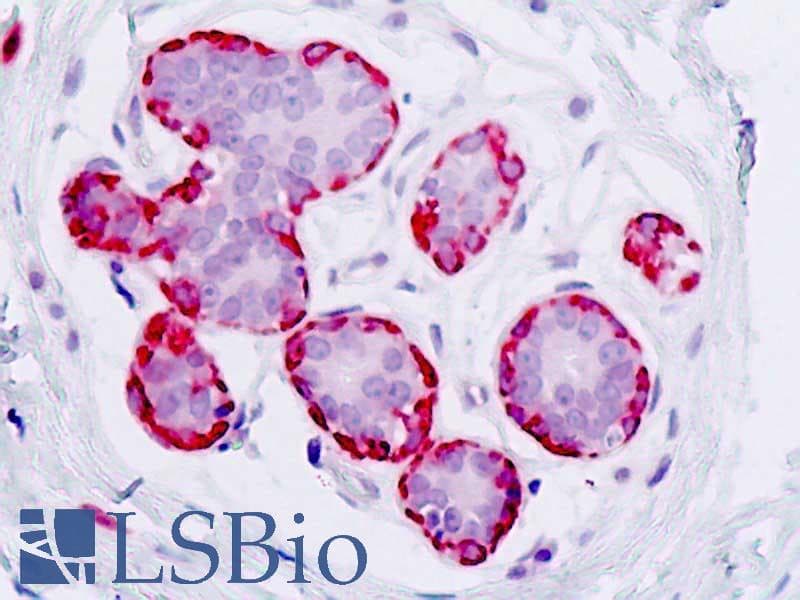 IHC-plus™ Polyclonal Rabbit anti-Human KLKB1 / Plasma Kallikrein Antibody (aa341-390, IHC, WB)