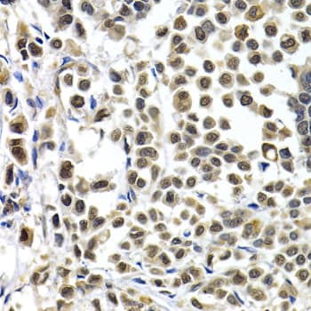 IRF2 Antibody