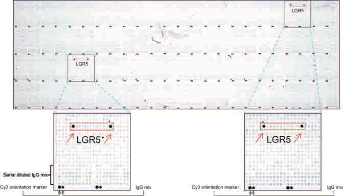 GPR49 / LGR5 Antibody (aa22-543, clone UMAB210)