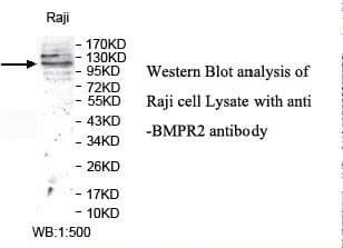 BMPR2 Antibody (aa295-552)