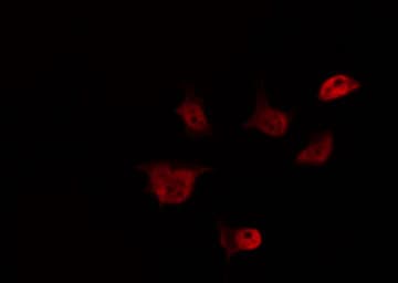 EID1 / EID-1 Antibody