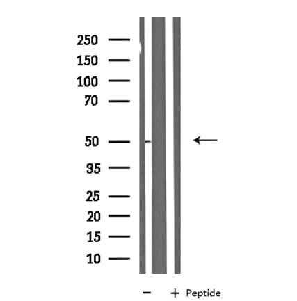 Polyclonal Rabbit anti-Human NBPF7 Antibody (IF, WB)