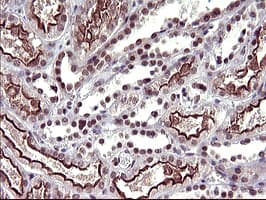 Monoclonal Mouse anti-Human UPRT Antibody (clone OTI1C9, IHC, WB)