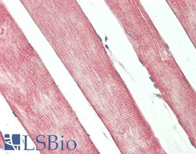 IHC-plus™ MYO1B / Myosin IB Antibody (aa916-1136)