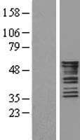 KRT8 / CK8 / Cytokeratin 8 Protein (Over-Expression Lysate Myc-DDK (Flag))