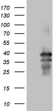 PDCL3 Antibody (clone OTI10A6)