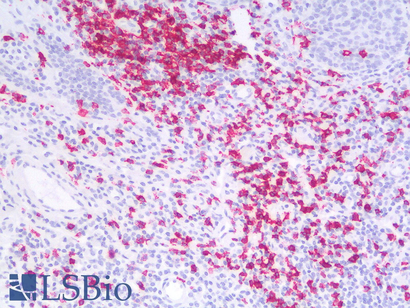 PathPlus™ CD20 Antibody (clone IGEL/1497R)
