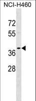 Polyclonal Rabbit anti-Human TPM2 Antibody (aa252-280, WB)