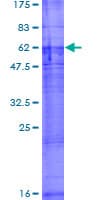 Human SLC22A18 Protein (Recombinant GST)
