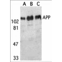 APP / Beta Amyloid Precursor Antibody