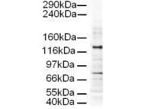 IHC-plus™ AP3D1 / Adaptin Delta Antibody (aa675-700)