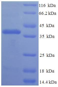 Human FIBIN Protein (Recombinant His-SUMO)