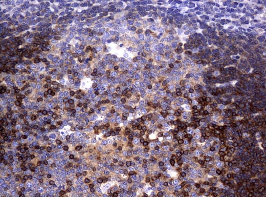 DEF6 Antibody (clone UMAB51)
