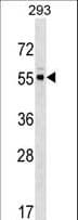 PACSIN3 Antibody (aa1-30)