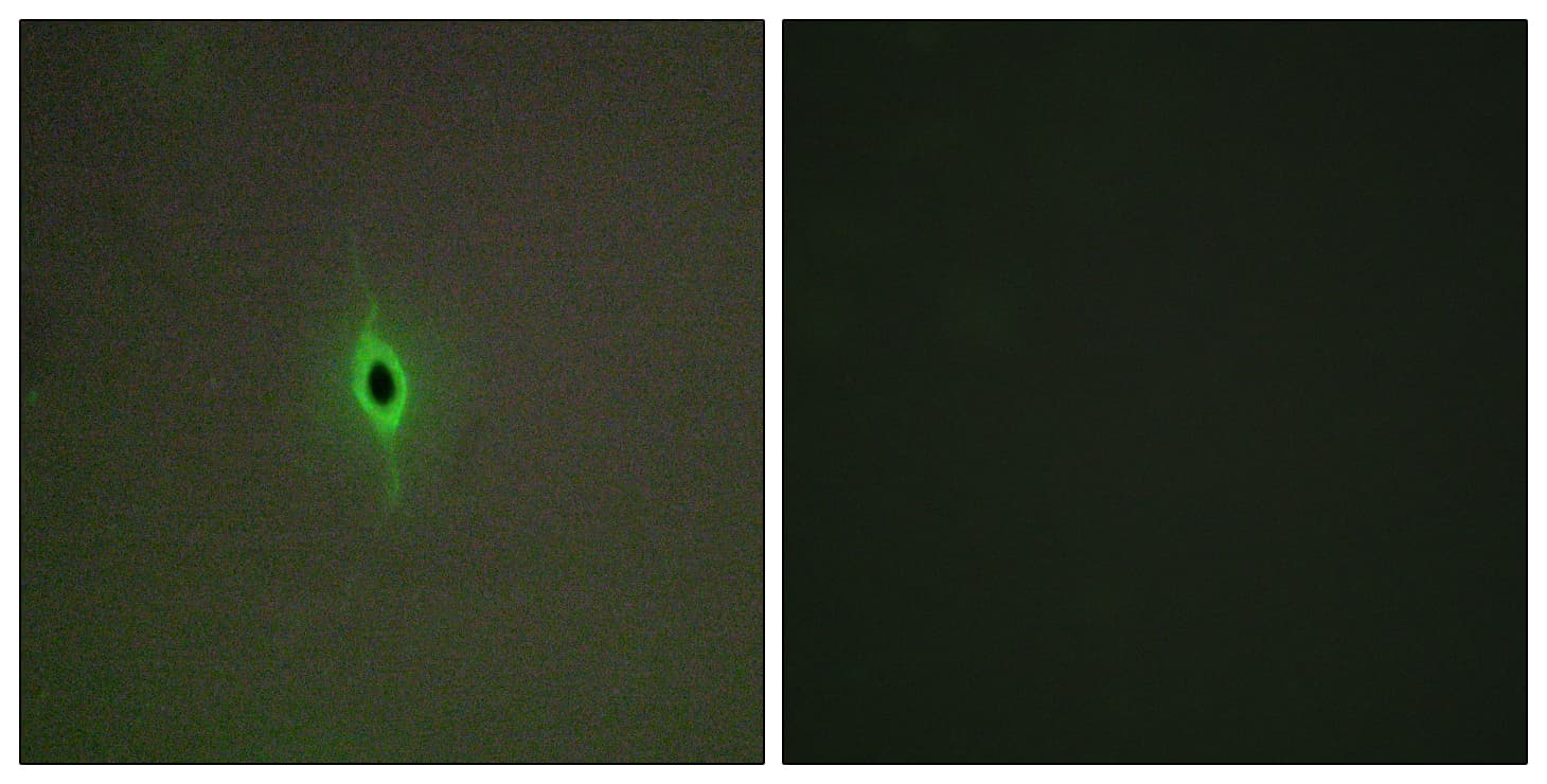 Polyclonal Rabbit anti-Human HTR2C / 5-HT2C Receptor Antibody (aa161-210, IHC, IF)