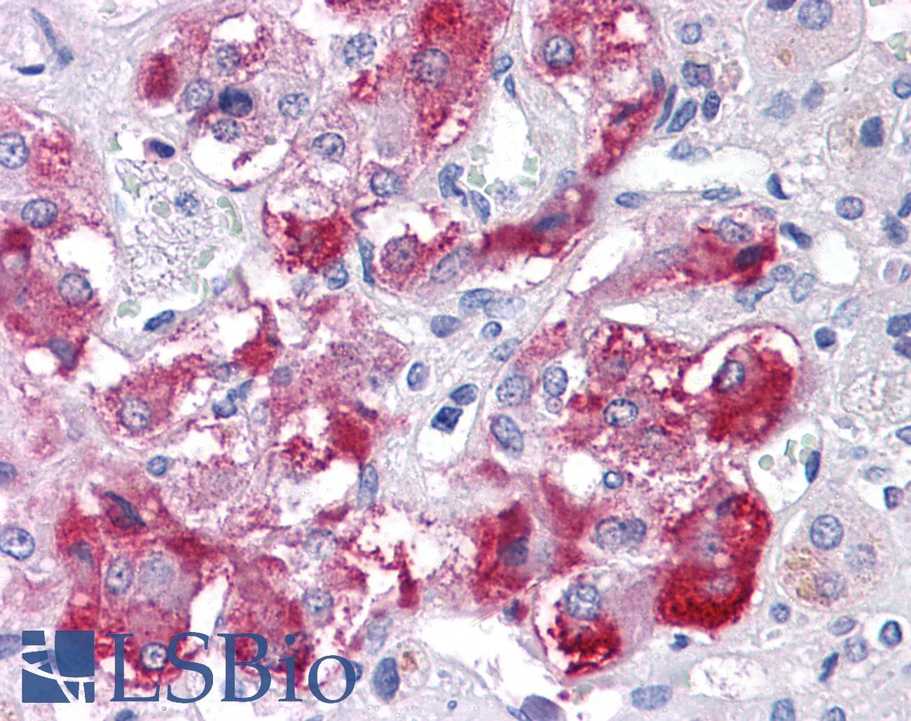 IHC-plus™ Polyclonal Rabbit anti-Human TM9SF1 Antibody (N-Terminus, IHC)