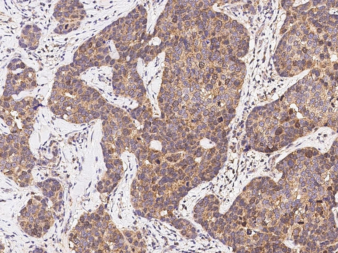 BIRC5 / Survivin Antibody (Preservative Free)