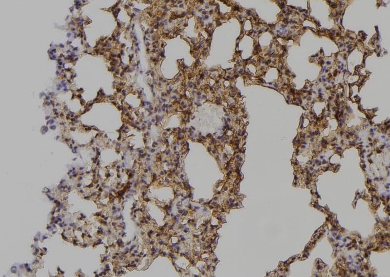 Polyclonal Rabbit anti-Human PPP1R12A / MYPT1 Antibody (IHC, WB)