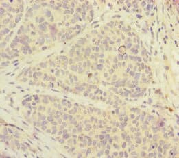 FOXRED1 Antibody