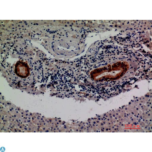F13B / TGase Antibody
