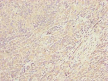 CEP57L1 Antibody