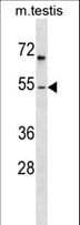 FOXF1 Antibody (aa21-50)
