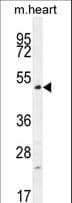 Polyclonal Rabbit anti-Human TSPYL4 Antibody (aa322-350, WB)