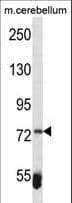 ZBTB39 Antibody (aa231-258)