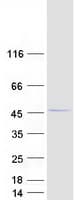 Human RHOXF2 Protein (Recombinant Myc-DDK (Flag))