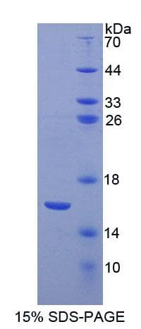 Human GNRH Protein (Recombinant His-S)
