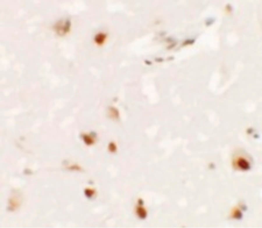 SHANK3 Antibody