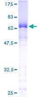 Human CTNNA3 / Alpha-3 Catenin Protein (Recombinant GST)