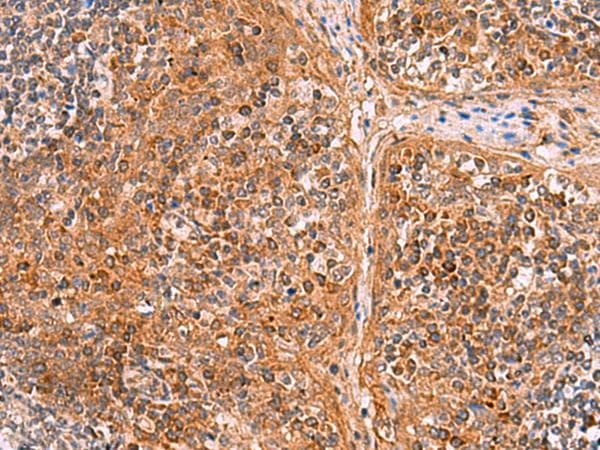 CREBBP / CREB Binding Protein Antibody