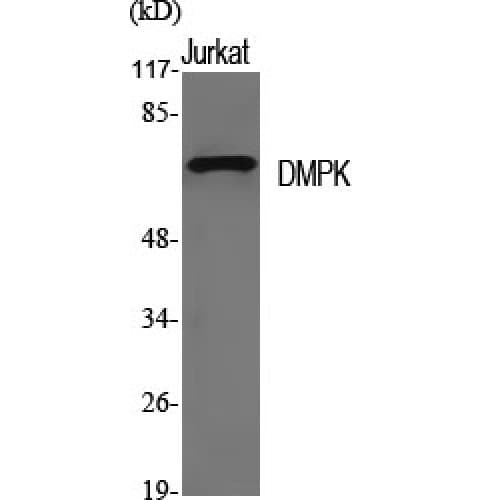 DMPK / DM Antibody (30-110 aa, N-terminal)