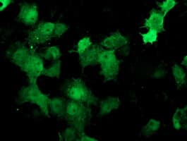 Monoclonal Mouse anti-Human Thymidylate Kinase Antibody (clone OTI2A1, IF, WB)