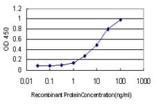 Monoclonal Mouse anti-Human ALDH3B2 Antibody (clone 3E6)