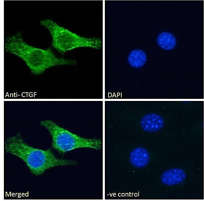 IHC-plus™ CTGF Antibody (Amino Acids 111-123)