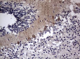 Hamartin / TSC1 Antibody (clone OTI5A8)