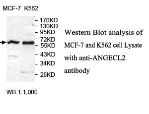 ANGEL2 Antibody (aa7-245)