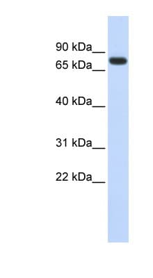 ANKRD13B Antibody (aa540-589)