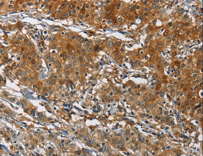 CAST / Calpastatin Antibody