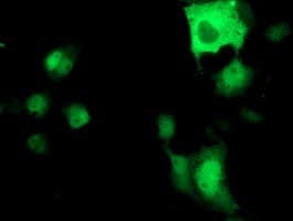 ATP6V1B1 Antibody (clone OTI6D2)
