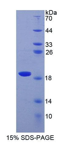 Human SOD1 / Cu-Zn SOD Protein (Recombinant His)