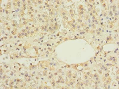 Polyclonal Rabbit anti-Human ZBTB43 Antibody (IHC)