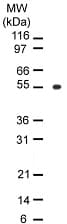 IHC-plus™ Monoclonal Mouse anti-Human OPG / Osteoprotegerin Antibody (clone 98A1071, aa20-37, IHC, WB)