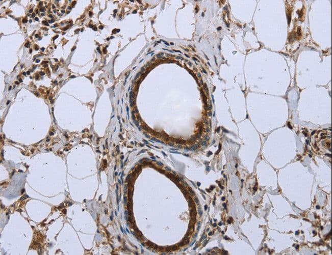 FBP1 Antibody