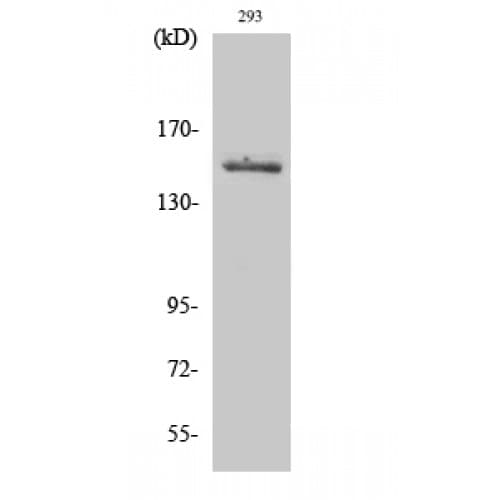 TYK2 Antibody (980-1060 aa)