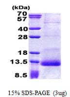 Human SPINK1 Protein (Recombinant His)