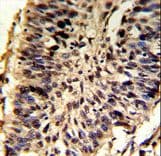 Polyclonal Rabbit anti-Human SNRPD2 Antibody (aa1-30, IHC, WB)